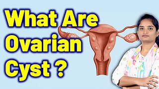 What Are Ovarian Cyst, Female Ovarian Cyst, Endometriotic Cyst | Homeopathy Medicine Cure & Surgery