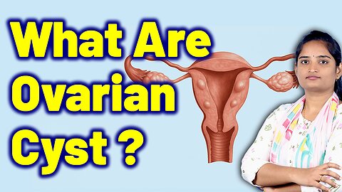 What Are Ovarian Cyst, Female Ovarian Cyst, Endometriotic Cyst | Homeopathy Medicine Cure & Surgery