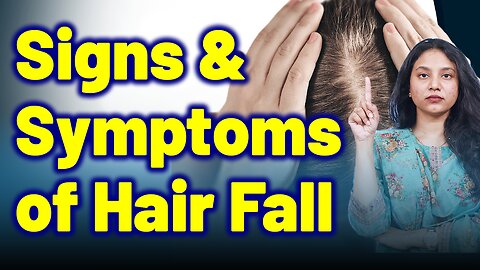 Symptoms & Signs of Telogen Effluvium,Hair Fall |Treatment Cure Skin Hair Nail | Homeopathy