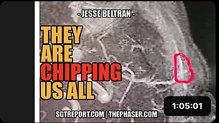 THEY ARE CHIPPING HUMANITY -- Jesse Beltran