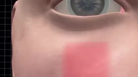 For the first time in Canada surgeons put teeth in patients' eyes to restore sight