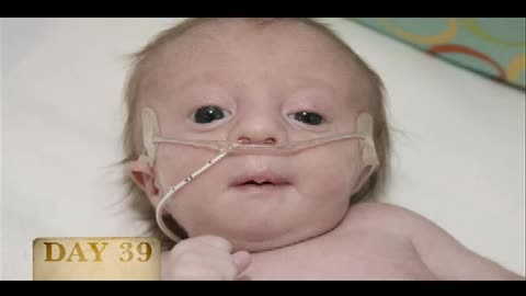 When I watch this I feel sorry for the person who opts for abortion. They miss Gods grace