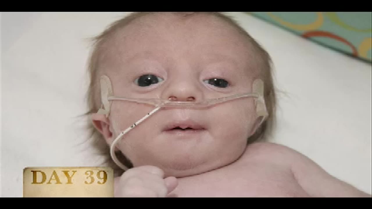 When I watch this I feel sorry for the person who opts for abortion. They miss Gods grace