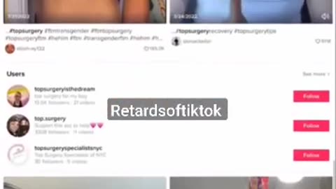 Transgender Surgery: Removing Breasts