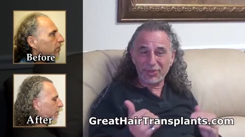 Dr. Brett Bolton Best Hair Transplant Surgeon in Florida - Tallahassee - Promo