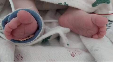Heart Warrior Mauled by Dog – Please Help Our Son Heal