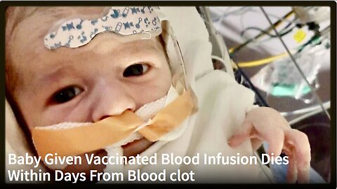 "Infant Passes Away from Blood Clot Days After Receiving Vaccinated Blood Transfusion"