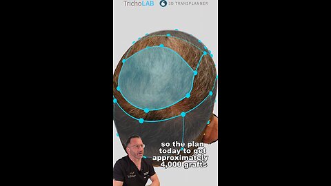 Diffuse thinning reinforced!