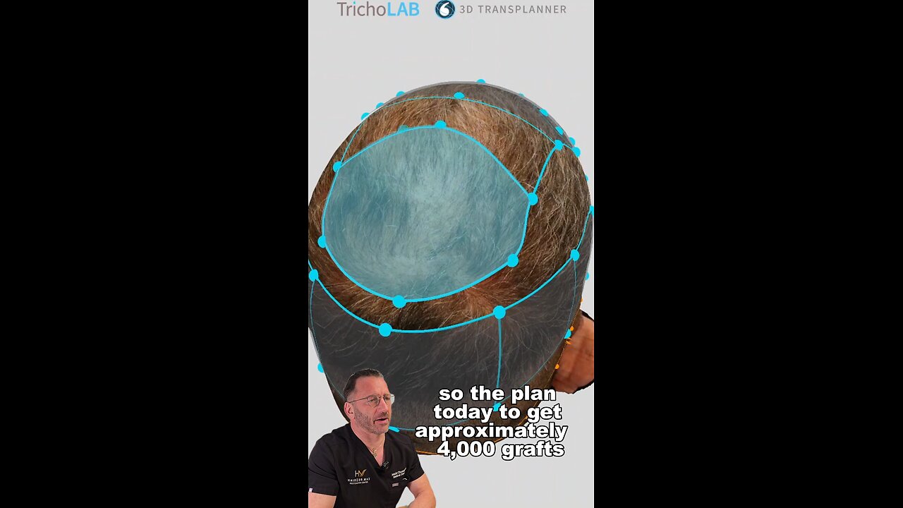 Diffuse thinning reinforced!