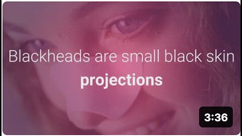 "Natural Blackhead Removal Methods"