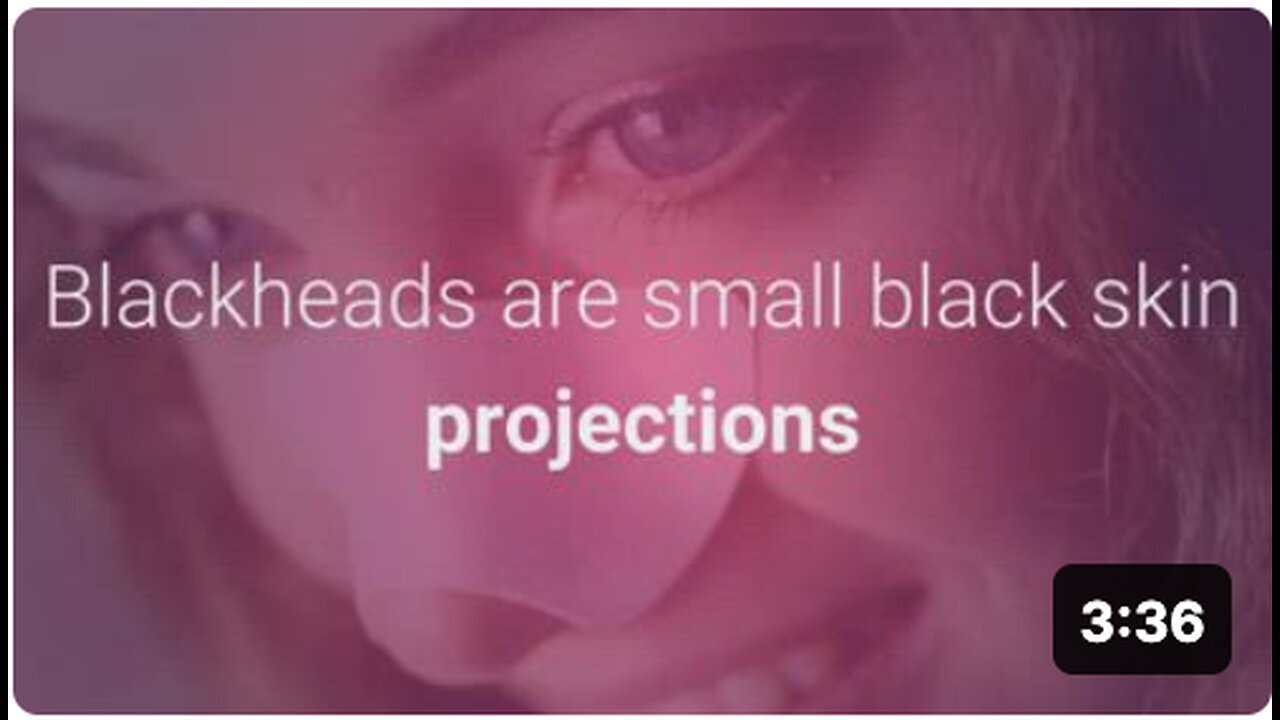 "Natural Blackhead Removal Methods"