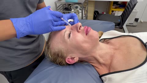 Cryotherapy & Anti-Wrinkle Injections at Chevron Advanced Medical 🩺