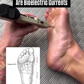 Acupuncture Points are DC Circuits!