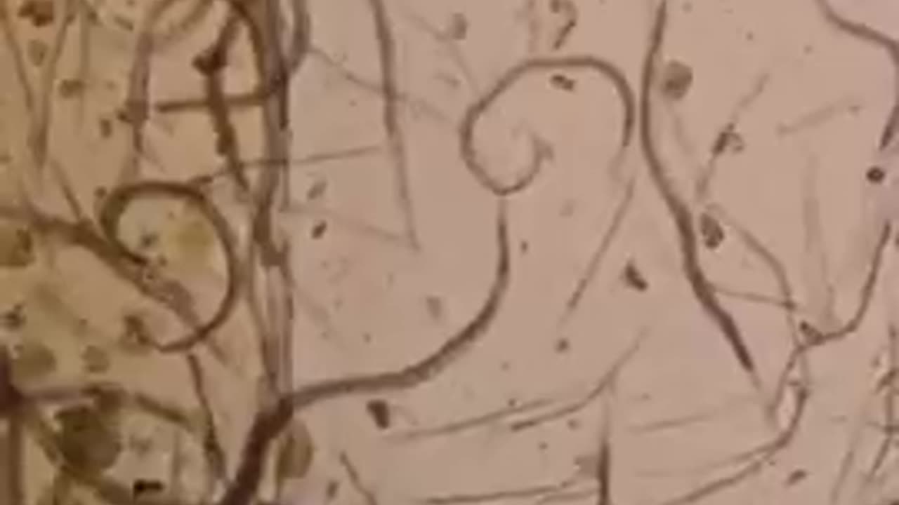 CAYENNE PEPPER VS HUMAN PARASITES (under the microscope)
