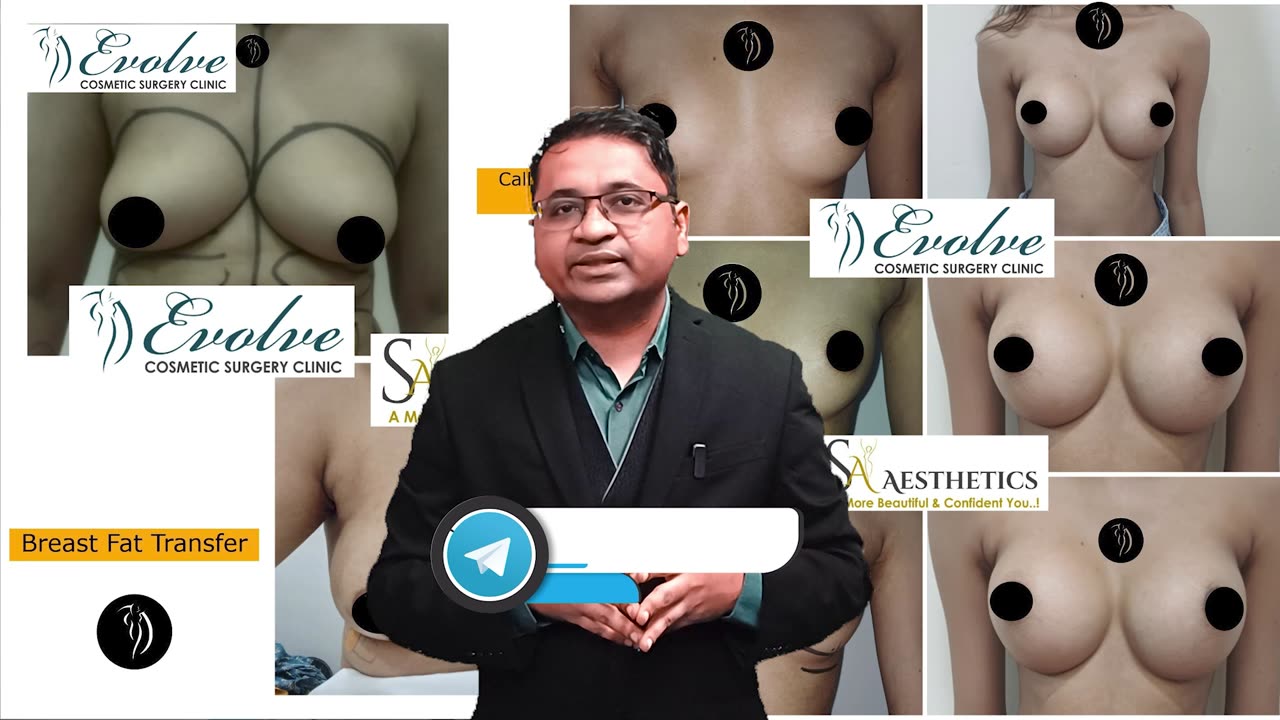 Breast Implants vs Fat Transfer | Which Augmentation Is Right for You? @evolvecosmeticclinic