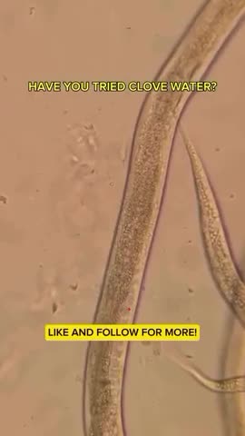 The power of CLOVE WATER vs HUMAN PARASITE 🪱