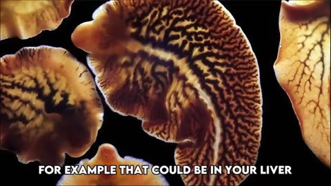 Surprising Signs You May Have Parasites (And What to Do About It)
