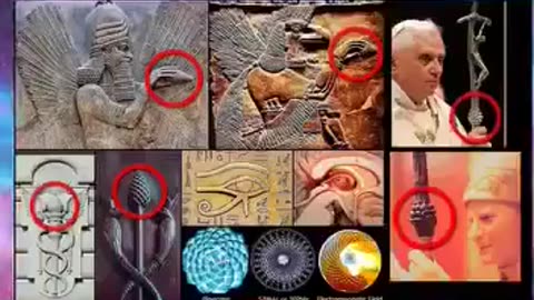 Pineal Gland