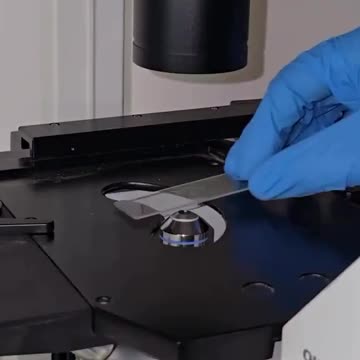 The Power of CLOVES WATER vs HUMAN PARASITE 🪱