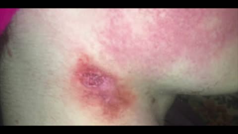 Mysterious blood sucking creature attacks