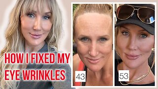 How I Fixed My Eye Wrinkles - Methods That ACTUALLY Work!