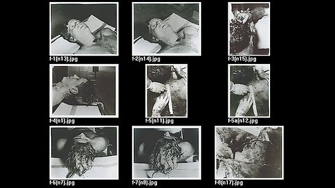 Kennedy Autopsy Photographs Research Video # 1 (1991 Mark A Crouch)
