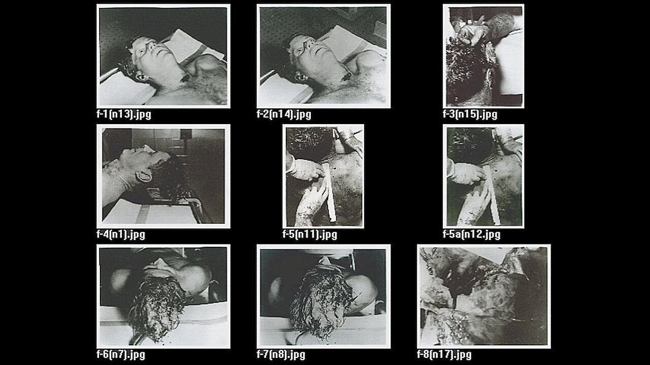 Kennedy Autopsy Photographs Research Video # 1 (1991 Mark A Crouch)