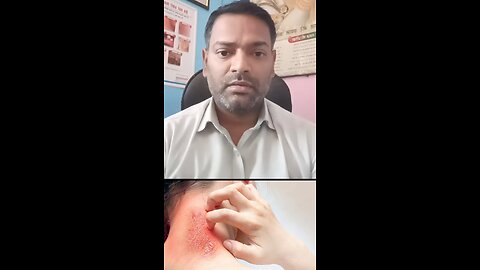 सामान्य त्वचा के रोग ।