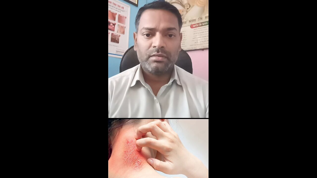 सामान्य त्वचा के रोग ।