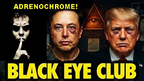 Tamara Magdalene Lioness of THE Yeshua Video 21 of 265: The Black Eye Club!