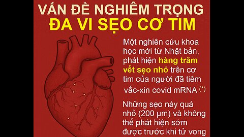 Nghiêm trọng - đa vi sẹo cơ tim sau tiêm covid