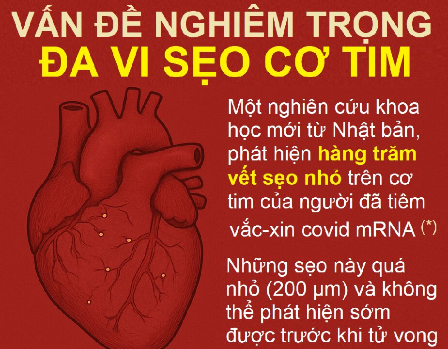 Nghiêm trọng - đa vi sẹo cơ tim sau tiêm covid