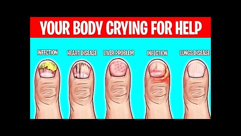 6 WEIRD Ways Your Body Tells You Have a Disease