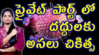 ప్రైవేట్ పార్ట్ లో దద్దులకు చికిత్స Best Treatment For Genital Blisters | Genital Herpes Homeopathy