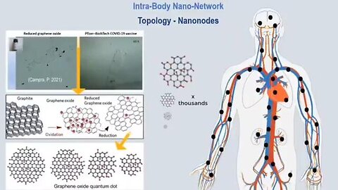 "Understanding Intra-Body Nano-Network: A Revolutionary Health Innovation Explained"