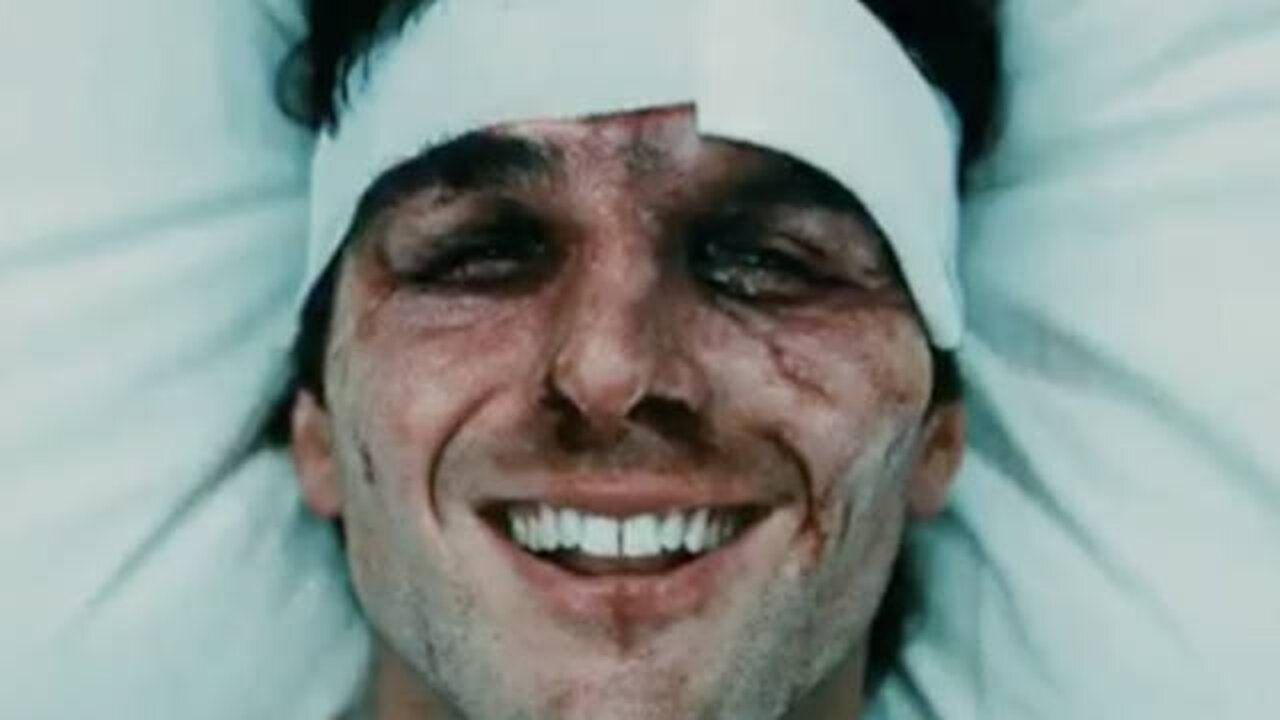 Man Walks Into Helicopter Rotor & Loses Half his Face But Lives