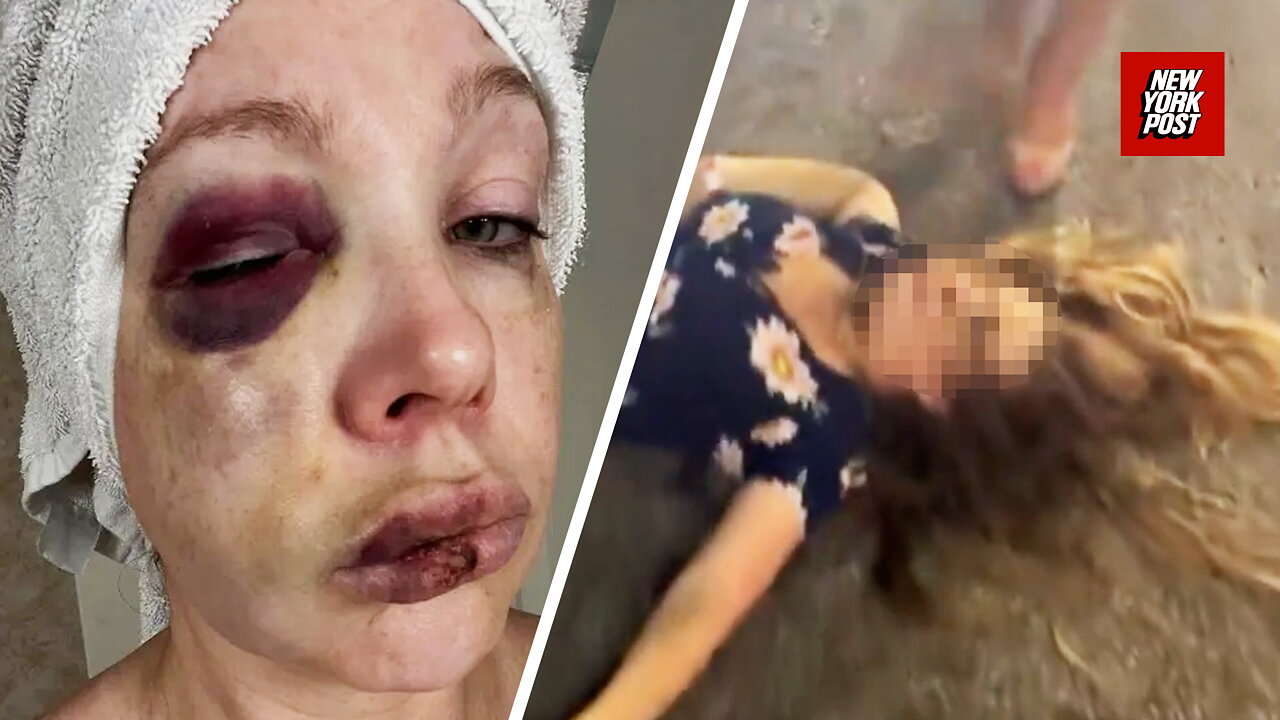 Woman beaten in Cincinnati brawl goes home to Russia – as attackers family says people only care because shes white