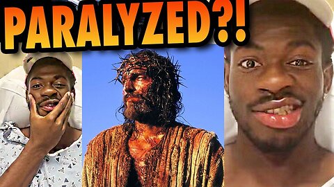 Big Satanist LIL NAS X Lost Control of Face! Hospitalized!!