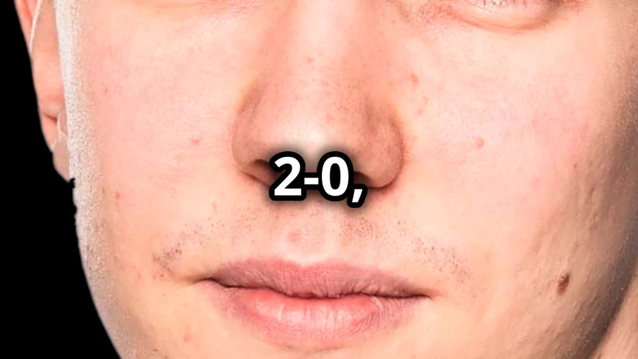 Manchester City vann trots chocköppningen