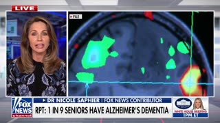 FDA Approves Breakthrough Alzheimer’s Blood Test for Early Detection