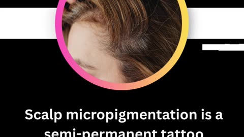 Scalp Tattoo Near Vancouver: Affordable Solution for Hair Loss Problems
