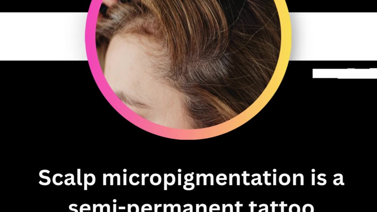 Scalp Tattoo Near Vancouver: Affordable Solution for Hair Loss Problems