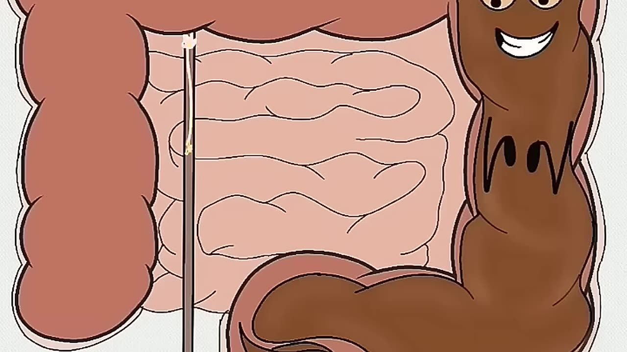 Try Not to Laugh Challenge - IMPOSSIBLE (You WILL Laugh!)Part-124#animation #cartoons #memes #comedy