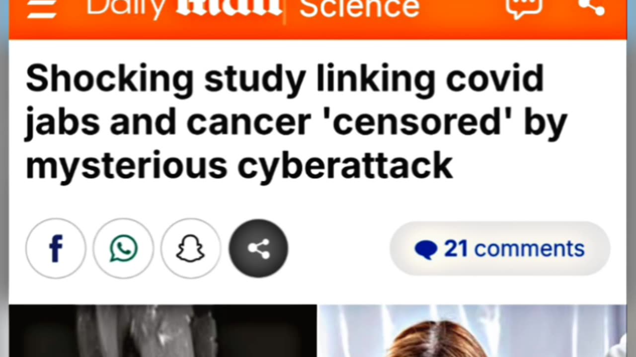 Scott Adams Covid Jab Victim