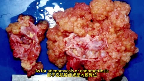女生特別易小腹凸 3法有效瘦小腹