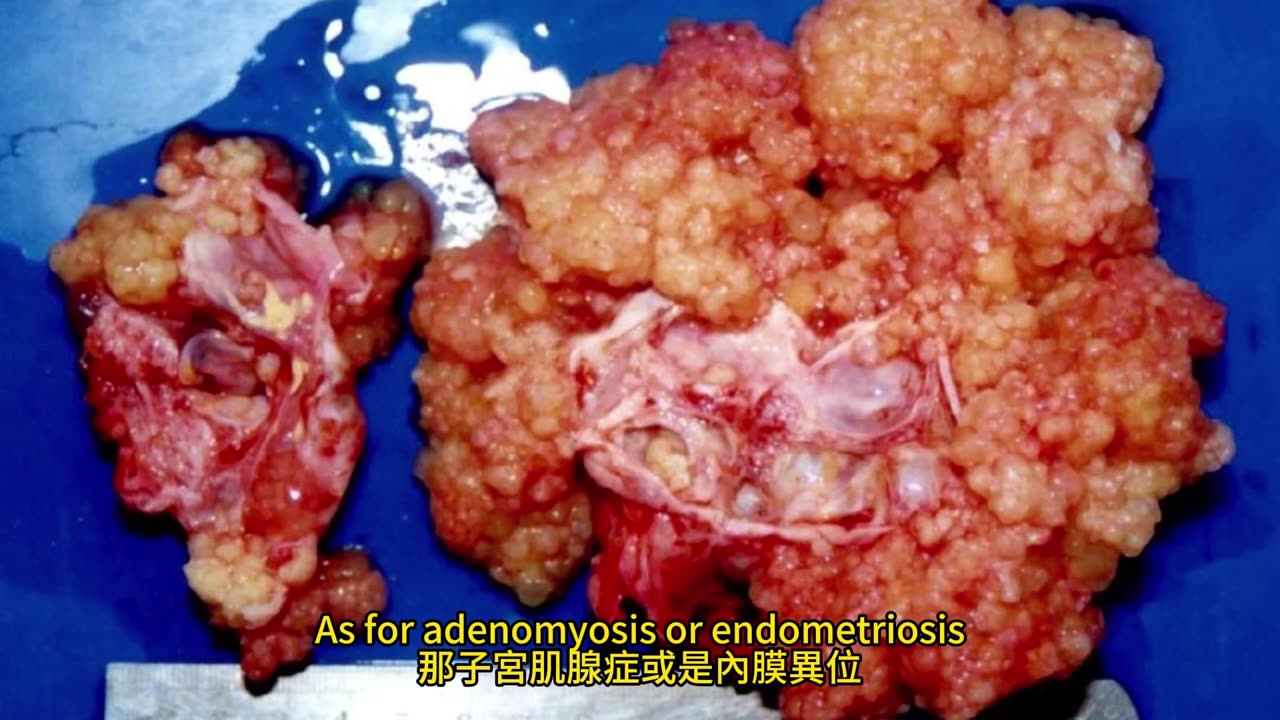 女生特別易小腹凸 3法有效瘦小腹