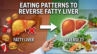Eating Patterns to Reverse Fatty Liver