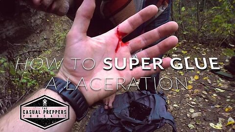 "Essential Medical Survival Guide: How to Super Glue a Laceration for Casual Preppers"