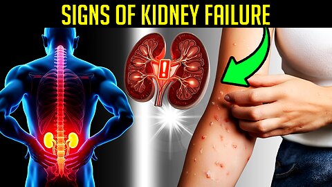 Health Alert: Kidney Failure Warning 8 Symptoms Most People Miss Until It’s Too Late