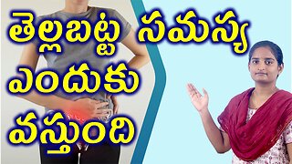తెల్లబట్ట సమస్య ఎందుకు వస్తుంది Structure Of Function White Discharge Homeopathy Treatment Medicine